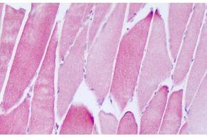Image no. 1 for anti-NADH Dehydrogenase (Ubiquinone) 1 alpha Subcomplex, Assembly Factor 2 (NDUFAF2) (AA 22-71) antibody (ABIN6749794)