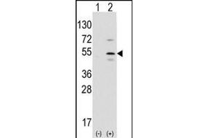Western blot analysis of Ptf1a (arrow) using rabbit polyclonal Ptf1a Antibody (N-term) (ABIN1881703 and ABIN2839321).