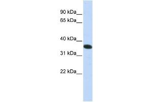 C21ORF59 antibody used at 1 ug/ml to detect target protein. (C21orf59 Antikörper  (N-Term))