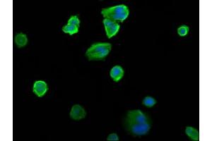 Immunofluorescence staining of MCF-7 cells with ABIN7151218 at 1:200, counter-stained with DAPI.