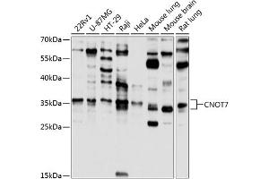 Western blot analysis of extracts of various cell lines, using CNOT7 antibody (ABIN6127563, ABIN6138783, ABIN6138784 and ABIN6224834) at 1:1000 dilution. (CNOT7 Antikörper  (AA 90-160))