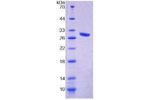 SDS-PAGE analysis of Mouse CHRNe Protein. (CHRNE Protein)