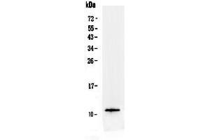 Western blot analysis of TFF3 using anti-TFF3 antibody . (TFF3 Antikörper  (AA 23-81))