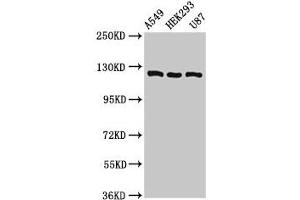 Western Blot Positive WB detected in: A549 whole cell lysate, HEK293 whole cell lysate, U87 whole cell lysate All lanes: ACLY antibody at 8 μg/mL Secondary Goat polyclonal to rabbit IgG at 1/50000 dilution Predicted band size: 121, 120, 92 kDa Observed band size: 121 kDa (ACLY Antikörper  (AA 4-265))