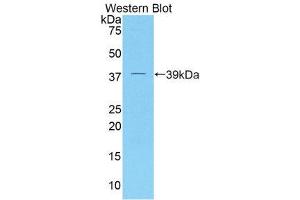 Western Blotting (WB) image for anti-Dickkopf Homolog 4 (Xenopus Laevis) (DKK4) (AA 37-141) antibody (ABIN3202023) (DKK4 Antikörper  (AA 37-141))