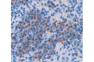 Immunohistochemistry (IHC) image for anti-IMP (Inosine 5'-Monophosphate) Dehydrogenase 2 (IMPDH2) (AA 226-514) antibody (ABIN1868704)