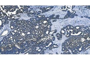 IHC analysis of PCBP2/hnRNP E2 using anti-PCBP2/hnRNP E2 antibody (ABIN7600449). (PCBP2 Antikörper  (AA 197-276))