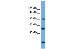 Western Blot showing EXOC1 antibody used at a concentration of 1-2 ug/ml to detect its target protein. (EXOC1 Antikörper  (N-Term))