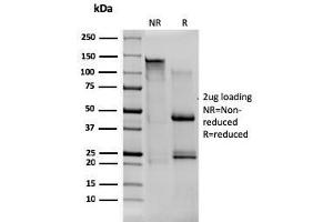 SDS-PAGE Analysis Purified CD80 Mouse Monoclonal Antibody (C80/1608). (CD80 Antikörper)