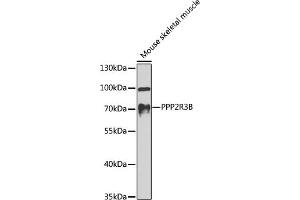Western blot analysis of extracts of mouse skeletal muscle, using PPP2R3B antibody (ABIN6128489, ABIN6146091, ABIN6146092 and ABIN6224568) at 1:1000 dilution. (PPP2R3B Antikörper  (AA 356-575))