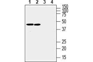 Western Blotting (WB) image for anti-Gap Junction Protein, beta 3, 31kDa (GJB3) (AA 216-228), (Intracellular) antibody (ABIN7043204)