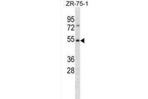 Western Blotting (WB) image for anti-F-Box and WD Repeat Domain Containing 4 (FBXW4) antibody (ABIN3001377) (FBXW4 Antikörper)