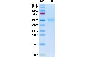 SDS-PAGE (SDS) image for Transforming Growth Factor, beta Receptor 1 (TGFBR1) (AA 34-125) protein (mFc-Avi Tag,Biotin) (ABIN7275721)