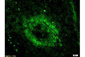 Formalin-fixed and paraffin embedded mouse lymphoma tissue labeled Anti-CD3 Polyclonal Antibody, Unconjugated (ABIN672921) 1:200, followed by conjugation to the secondary antibody Goat Anti-Rabbit IgG, FITC conjugated used at 1:200 dilution for 40 minutes at 37°C. (CD3 epsilon Antikörper  (AA 101-189))