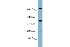WB Suggested Anti-RWDD1 Antibody Titration: 0. (RWDD1 Antikörper  (Middle Region))