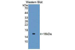 Western blot analysis of the recombinant protein. (TSPAN1 Antikörper  (AA 112-215))