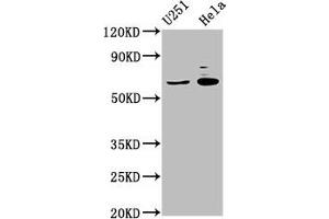 Western Blot Positive WB detected in: U251 whole cell lysate, Hela whole cell lysate All lanes: GABRA4 antibody at 7 μg/mL Secondary Goat polyclonal to rabbit IgG at 1/50000 dilution Predicted band size: 62 kDa Observed band size: 62 kDa (GABRA4 Antikörper  (AA 36-258))