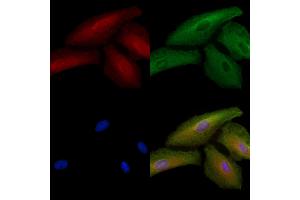 ABIN6264925 and ABIN6278520 staining  cells by IF/ICC. (SGCB Antikörper  (N-Term))