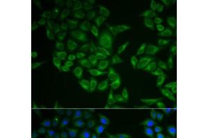 Immunofluorescence analysis of A549 cells using CD247 Polyclonal Antibody (CD247 Antikörper)