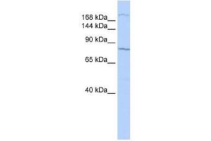 UBR1 antibody used at 1 ug/ml to detect target protein.