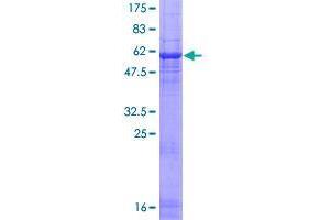 RCBTB1 Protein (AA 1-355) (GST tag)