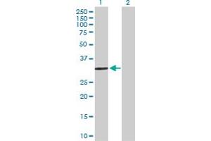 Western Blot analysis of SULT1E1 expression in transfected 293T cell line by SULT1E1 MaxPab polyclonal antibody.