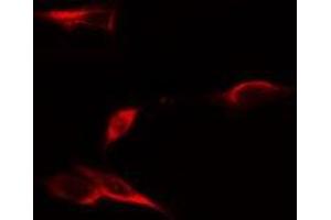 ABIN6275061 staining LOVO cells by IF/ICC. (DPYSL4 Antikörper  (Internal Region))