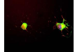 We obtained Neuromics E18 hippocampal neurons and grew them for seven days following the Neuromics protocol. (MAPT Antikörper)
