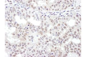 anti-NFKB Repressing Factor (NKRF) (AA 50-100) antibody