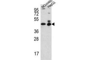 Western Blotting (WB) image for anti-Actin-Like 6B (ACTL6B) antibody (ABIN3002303) (Actin-Like 6B Antikörper)