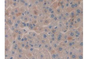 Immunohistochemistry (IHC) image for anti-serum/glucocorticoid Regulated Kinase Family, Member 3 (SGK3) (AA 141-368) antibody (ABIN1860541)
