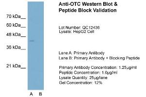 Host:  Rabbit  Target Name:  OTC  Sample Type:  HepG2  Lane A:  Primary Antibody  Lane B:  Primary Antibody + Blocking Peptide  Primary Antibody Concentration:  1. (OTC Antikörper  (N-Term))