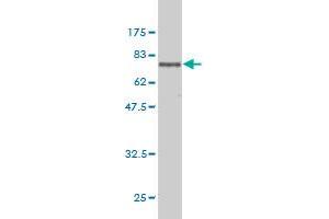 Western Blotting (WB) image for anti-tRNA Aspartic Acid Methyltransferase 1 (TRDMT1) (AA 1-391) antibody (ABIN560633)
