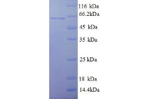 SDS-PAGE (SDS) image for Dihydrolipoyl Transacetylase (DLAT) (AA 93-640), (partial) protein (His tag) (ABIN5709403) (DLAT Protein (AA 93-640, partial) (His tag))