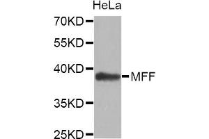 Western blot analysis of extracts of HeLa cell line, using MFF antibody. (MFF Antikörper)