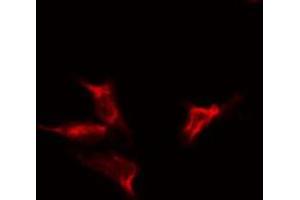 ABIN6275325 staining  HeLa cells by IF/ICC. (NUTF2 Antikörper  (Internal Region))