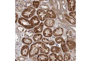Immunohistochemical staining of human kidney with VPS37A polyclonal antibody  shows strong cytoplasmic positivity in tubular cells. (VPS37A Antikörper)
