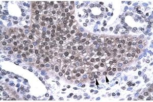 Immunohistochemistry (IHC) image for anti-TAF15 RNA Polymerase II, TATA Box Binding Protein (TBP)-Associated Factor, 68kDa (TAF15) (N-Term) antibody (ABIN2779283)