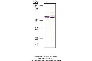 Image no. 1 for anti-Retinal Pigment Epithelium-Specific Protein 65kDa (RPE65) antibody (ABIN363219) (RPE65 Antikörper)