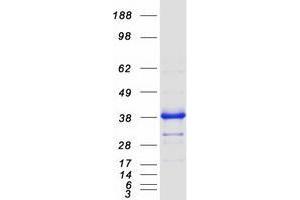 Western Blotting (WB) image for Uracil-DNA Glycosylase (UNG) (Transcript Variant 2) protein (Myc-DYKDDDDK Tag) (ABIN2735064)