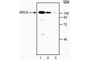 Western blot analysis of MSH-2. (MSH2 Antikörper)