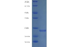 SDS-PAGE (SDS) image for Shiga Toxin Subunit B (STXB) (AA 20-89) protein (His-SUMO Tag) (ABIN5711020)