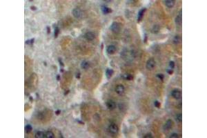 Used in DAB staining on fromalin fixed paraffin-embedded Liver tissue (Fatty Acid Synthase Antikörper  (AA 26-78))