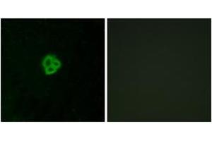 Immunofluorescence analysis of MCF7 cells, using AGTR1 Antibody.