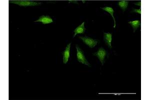 Immunofluorescence of monoclonal antibody to UBE2Z on HeLa cell.