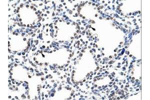 Image no. 1 for anti-Pumilio RNA Binding Family Member 3 (PUM3) (AA 61-110) antibody (ABIN203236) (KIAA0020 Antikörper  (AA 61-110))