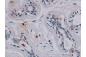 Detection of VEGF165 in Human Mammary gland Tissue using Monoclonal Antibody to Vascular Endothelial Growth Factor 165 (VEGF165) (VEGF 165 (AA 28-191) Antikörper)