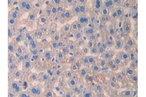 Used in DAB staining on fromalin fixed paraffin- embedded stomach tissue (IL13 Receptor alpha 1 Antikörper  (AA 28-171))