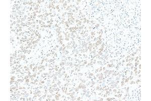 Immunohistochemistry (IHC) image for anti-Zinc Finger CCCH-Type Containing 4 (ZC3H4) (AA 1050-1100) antibody (ABIN7795761)