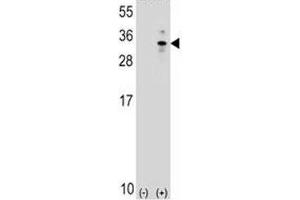 Western blot analysis of XBP1 antibody and 293 cell lysate (2 ug/lane) either nontransfected (Lane 1) or transiently transfected (2) with the human gene. (XBP1 Antikörper  (AA 62-91))